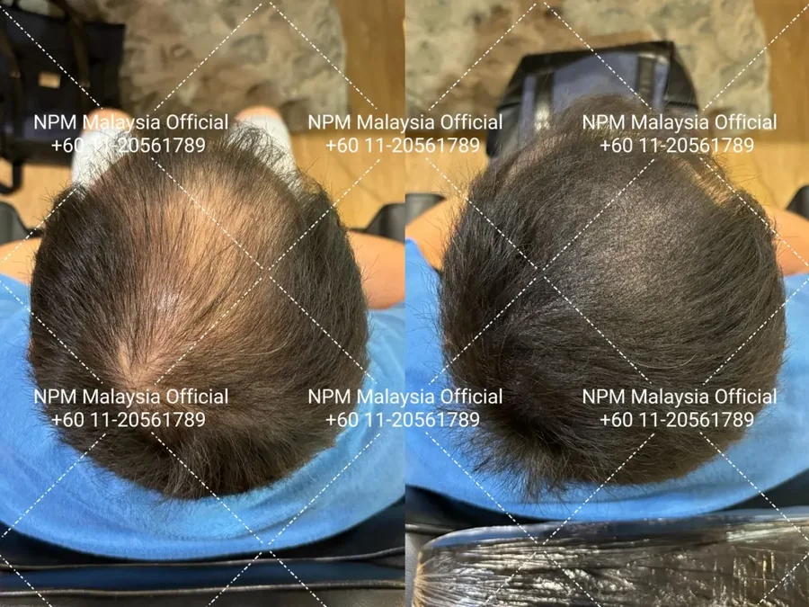 Kenapa kami memberi sebut harga selepas mengukur, bukan sebelum
