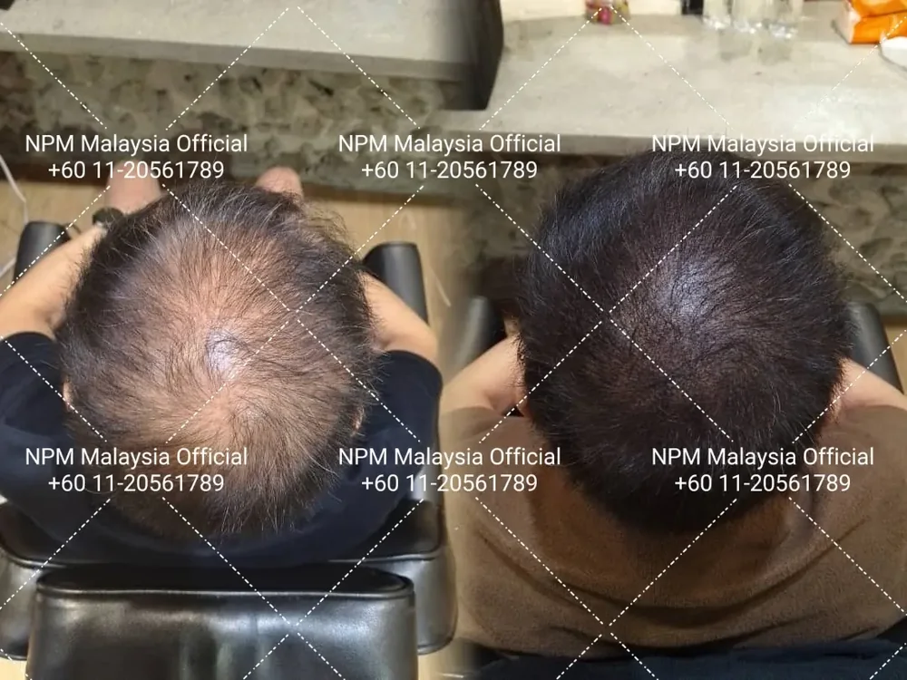 Before / after · shared with client permission