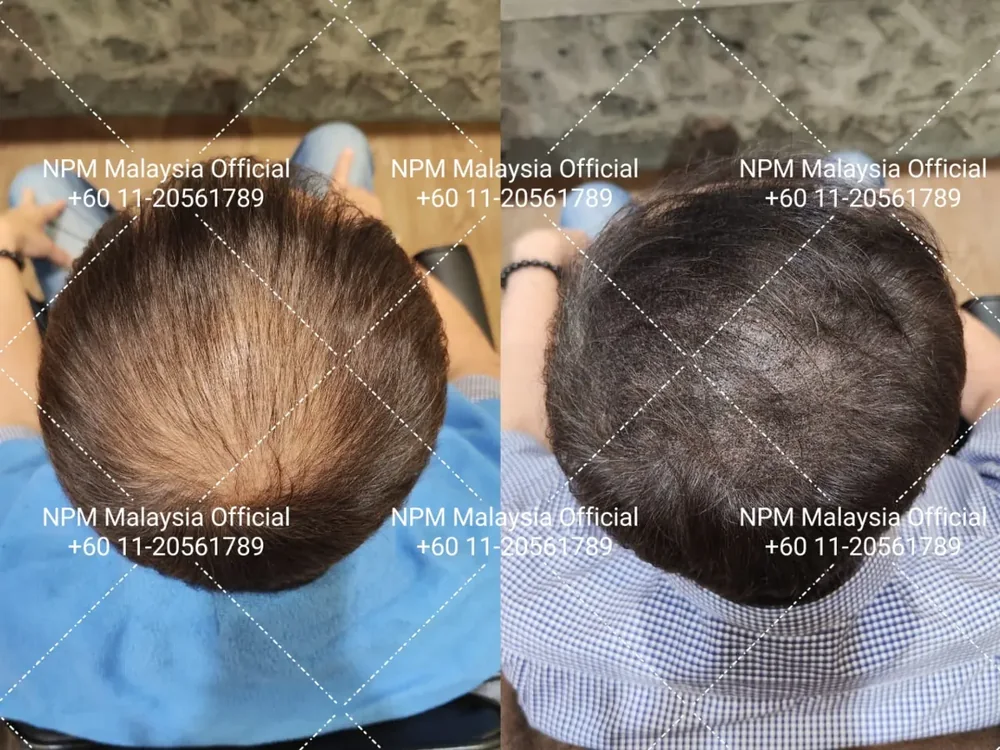 Before / after · shared with client permission