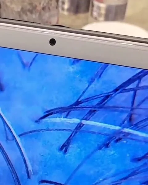 护理师进行头皮放大检测