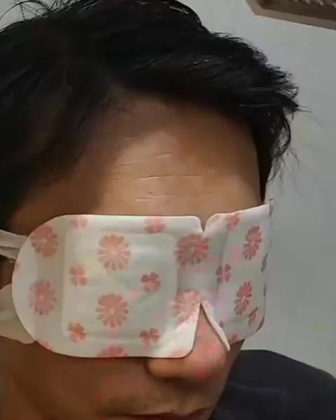 客户享受温热眼部蒸敷
