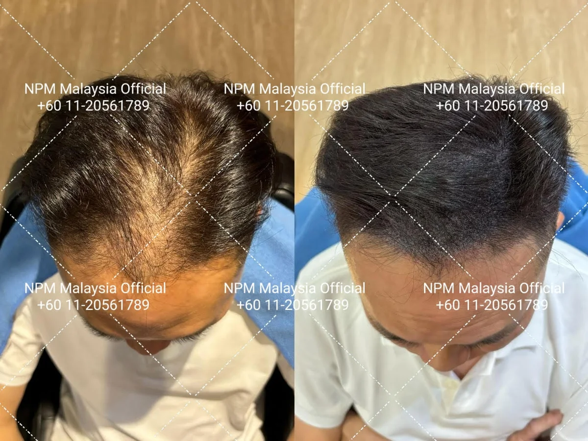 Pelanggan NPM Malaysia, sebelum dan selepas