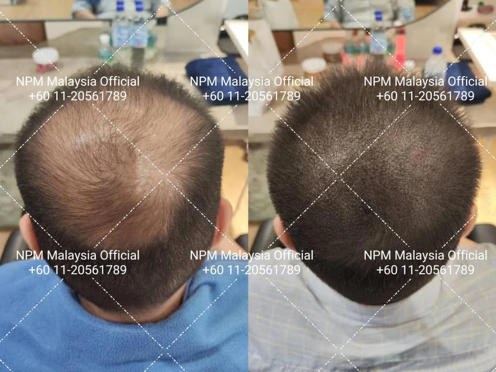 Pelanggan NPM Malaysia, sebelum dan selepas